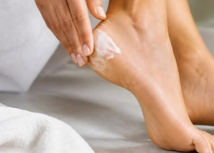 Lakukan Hal Ini, Cara Mengatasi Tumit Kaki Kering dan Pecah-Pecah