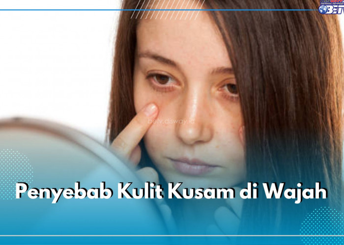 Kamu Wajib Tahu! Inilah 7 Penyebab Kulit Kusam di Wajah, Cek di Sini