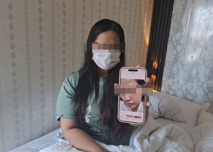 Perempuan Asal Lebong Jadi Korban KDRT di Hotel, Alami Trauma dan Laporkan Suami ke Polisi