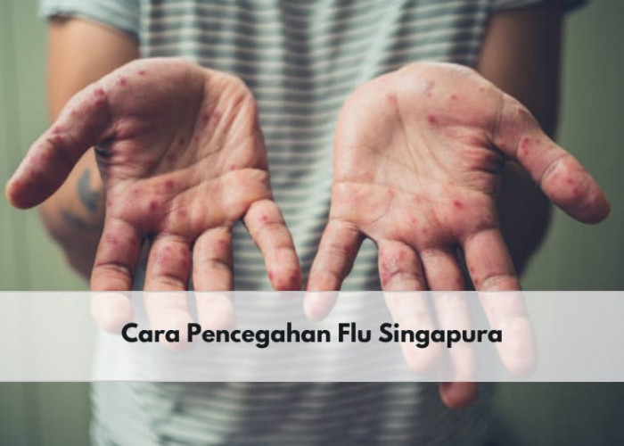 Semakin Marak Terjadi, Ini 5 Cara Efektif untuk Mencegah Flu Singapura pada Anak, Apa Saja?