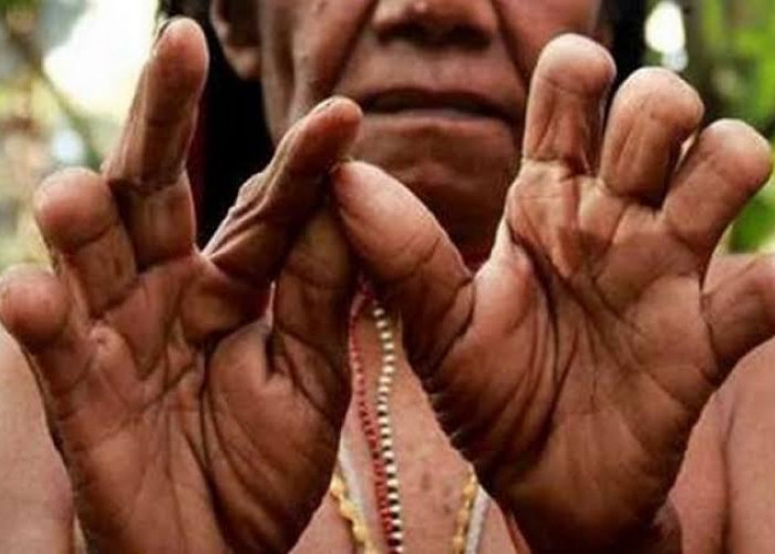 Mengenal Tradisi Ekstrem Potong Jari di Papua, Sebuah Simbol Kesetiaan Wanita yang Mendalam