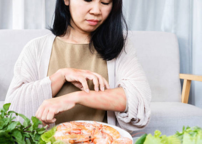 Jangan Diabaikan, Segera Kenali Gejala Alergi Seafood dan Cara Mengatasinya di Sini!