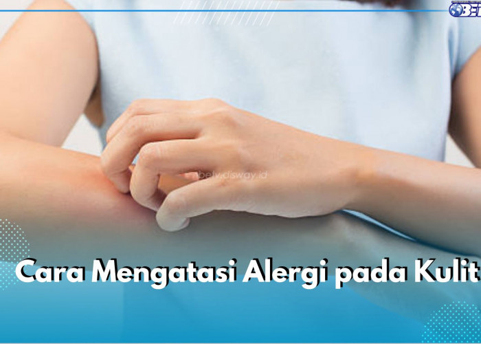 5 Cara Atasi Alergi pada Kulit, Salah Satunya Penggunaan Antihistamin