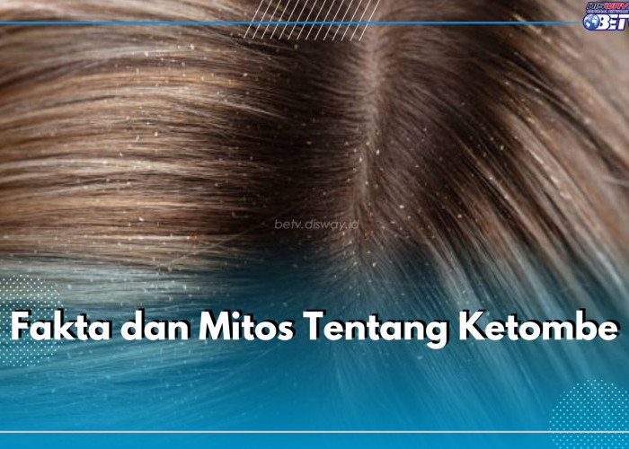 5 Fakta dan Mitos Soal Ketombe yang Jarang Diketahui, Pernah Dengar yang Mana?