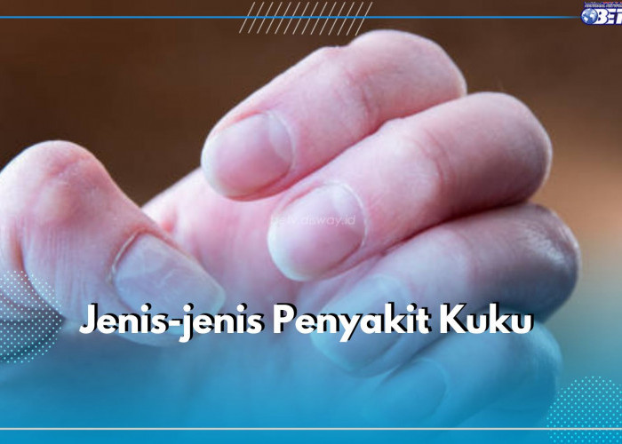 Awas! 5 Jenis Penyakit Kuku Ini Dapat Intai Tubuh, Bisa Jadi Tanda Penyakit Serius, Lho