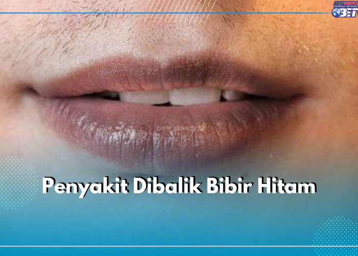 Jangan Abaikan Bibir Hitam Karena Bisa Jadi Tanda 4 Penyakit Ini, Cek Apa Saja!