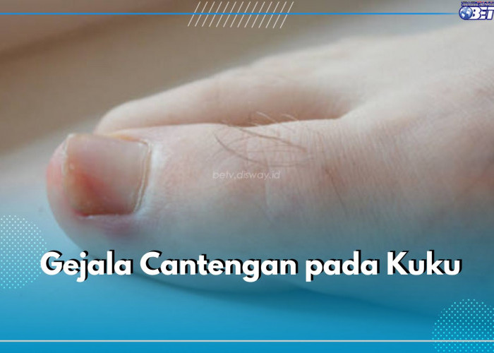 Kenali 5 Gejala Cantengan pada Kuku Ini dan Atasi Sebelum Parah! Apa Saja?