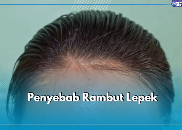 5 Penyebab Rambut Lepek yang Perlu Kamu Ketahui, Salah Satunya Frekuensi Keramas yang Tidak Tepat