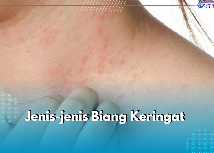 Punya Penyebab Berbeda, Ini Jenis-Jenis Biang Keringat yang Perlu Kamu Ketahui