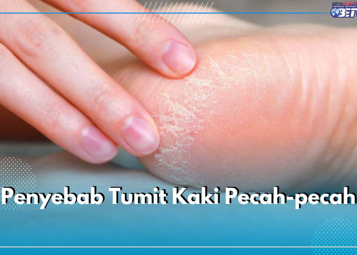 Ternyata Ini 5 Penyebab Tumit Kaki Pecah-Pecah, Salah Satunya Kulit Kering