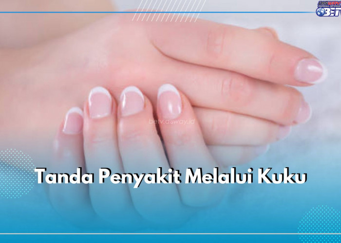 Ini 7 Tanda Penyakit yang Dapat Dikenali Melalui Kondisi Kuku, Apa Saja?