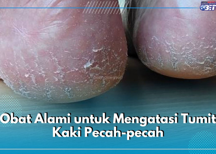 6 Obat Alami Ini Ampuh untuk Atasi Tumit Kaki Pecah-Pecah, Salah Satunya Minyak Kelapa