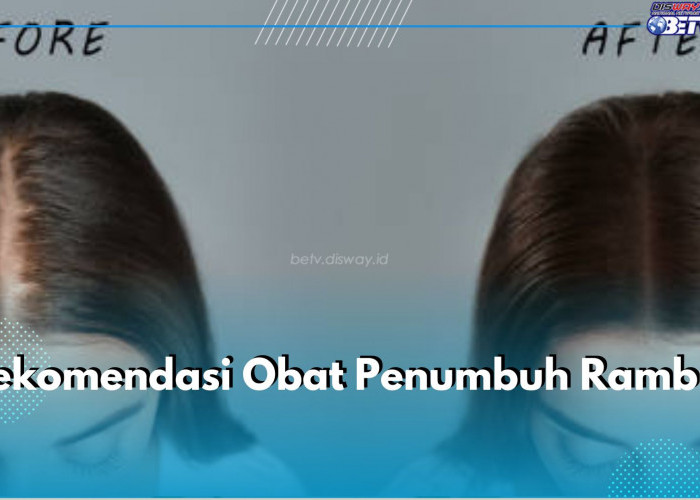 Halau Kebotakan dengan 5 Rekomendasi Obat Penumbuh Rambut Ini, Salah Satunya Minoxidil 