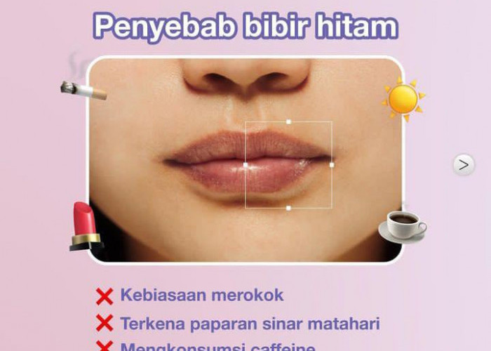 Punya Bibir Hitam? Ini 7 Cara Mudah Mengatasinya, Jadikan Bibirmu Sehat Alami