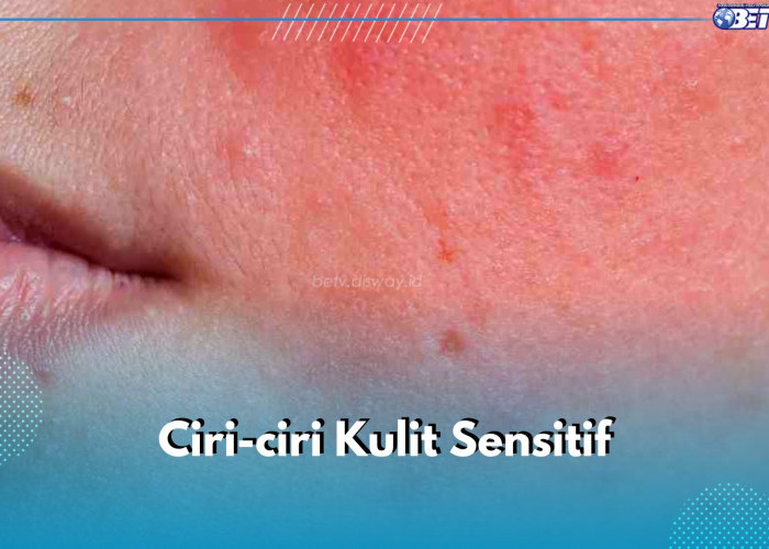 5 Ciri Kulit Sensitif yang Perlu Kamu Ketahui, Salah Satunya Kulit Mudah Merah