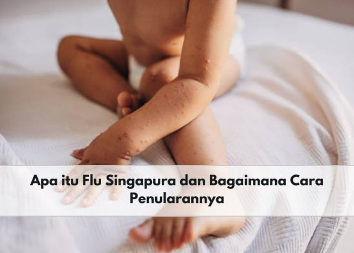 Ramai Terjadi pada Anak, Ketahui Apa Itu Flu Singapura dan Cara Penularannya