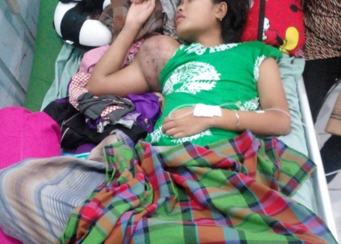Idap Tumor Ganas, Gadis 16 Tahun di Desa Simpang Butuh Uluran Tangan Dermawan