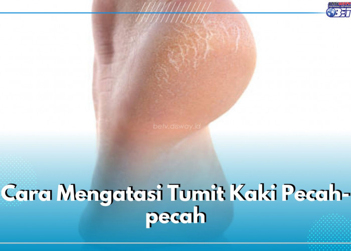 Ini 5 Cara Mudah Atasi Tumit Kaki Pecah-pecah, Coba Gunakan Pelembap Khusus