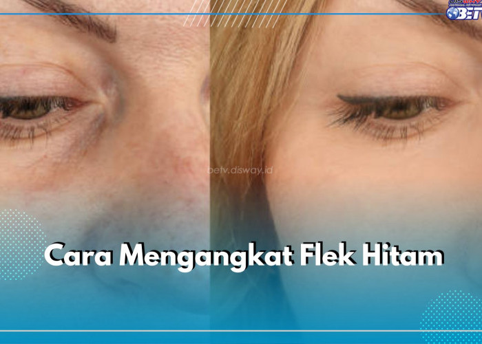 Cukup Gunakan 5 Bahan Alami, Begini Caranya Mengangkat Flek Hitam di Wajah