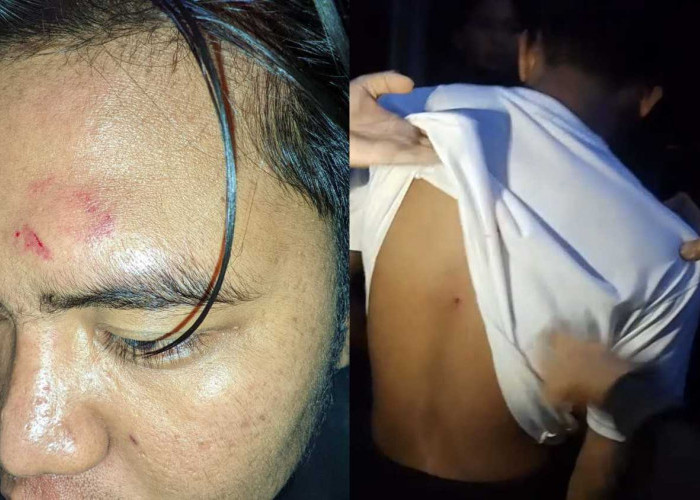 Hendak Nikmati Sunrise, 2 Pemuda Jadi Korban Penusukan Gengster di Danau Dendam Tak Sudah