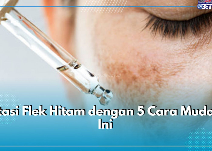 Atasi Flek Hitam dengan 5 Cara Mudah Ini, Dijamin Terangkat Hingga ke Akarnya!