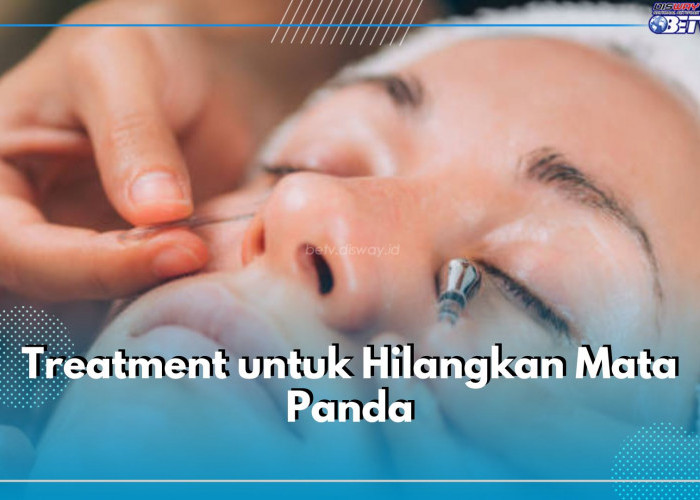 6 Treatment Ini Ampuh Hempas Mata Panda Selamanya, Cek Apa Saja!