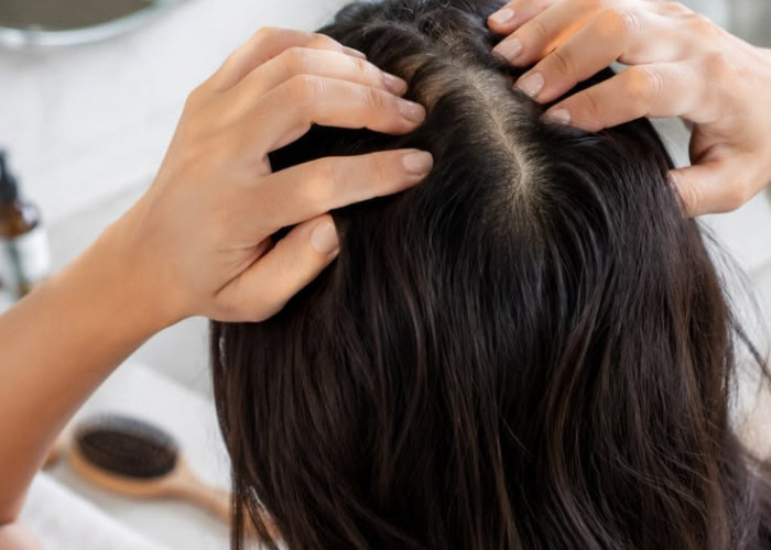 Bukan Cuma karena Usia, Ini Penyebab Lain Rambut Beruban