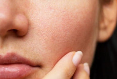 5 Cara Alami Atasi Pori-pori di Wajah, Bisa Gunakan Masker Kunyit Hingga Scrub Madu