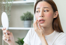Cara Mengatasi Kulit Wajah Kering, Kulit Tetap Lembap dan Cocok untuk Sehari-hari