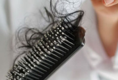 Ini Penyebab Rambut Sering Rontok yang Perlu Diketahui, Jangan Diabaikan