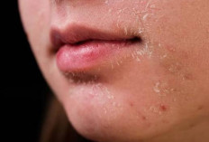 Jangan Salah Pilih! Ini Dia Rekomendasi Sunscreen untuk Pemilik Kulit Kering