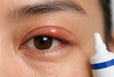 Mata Bintitan Susah Sembuh? Coba Atasi dengan Pilihan Salep Ini!