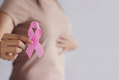 Tak Lagi Usia Tua, Tren Kanker Payudara Bergeser ke Anak Muda, Dokter Ungkap Biang Keroknya